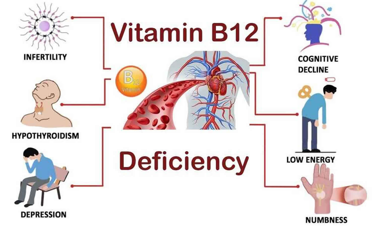 vitamin b12 deficiency